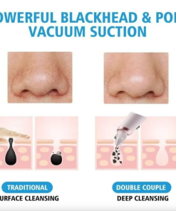 апарат за отстранување акни и митесери - aparat za otstranuvanje akni i miteseri - aparat za otstranuvane akni i miteseri - Слика 6