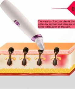 апарат за отстранување акни и митесери - aparat za otstranuvanje akni i miteseri - aparat za otstranuvane akni i miteseri - Слика 2